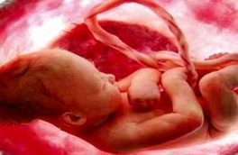 طرح  مجلس در مورد سقط جنین با افزایش جمعیت ارتباطی ندارد