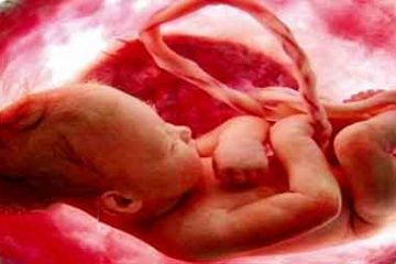 طرح  مجلس در مورد سقط جنین با افزایش جمعیت ارتباطی ندارد